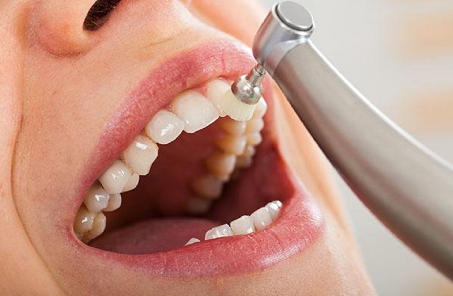 Importance of Dental Cleanings in Preventing Periodontal Disease